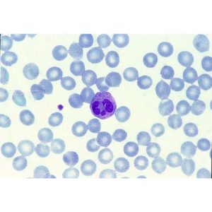 Sang humain, détail globules blancs, frottis