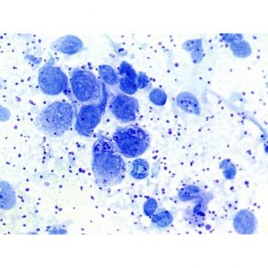 Rate, frottis : lymphocytes, macrophages et plasmocytes